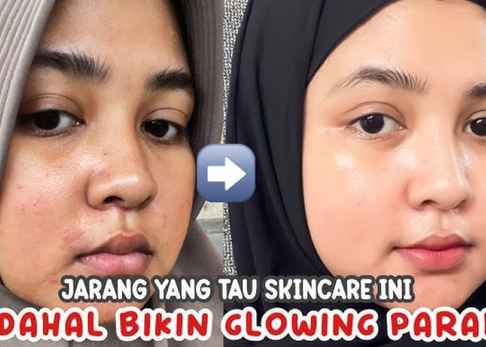 4 Sunscreen Bikin Wajah Glowing Bebas Flek Hitam, Rahasia Awet Muda Tanpa Kerutan Gak Pakai Lama