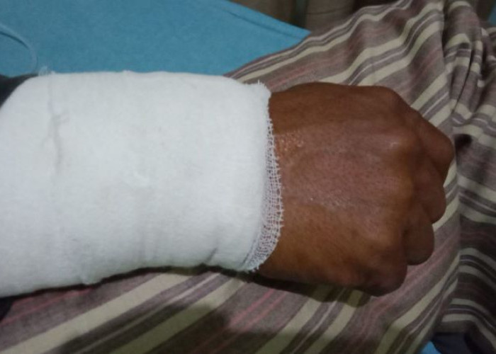 Petugas Damkar Digigit Ular Sanca, Jalani Operasi di RSUD Kajen