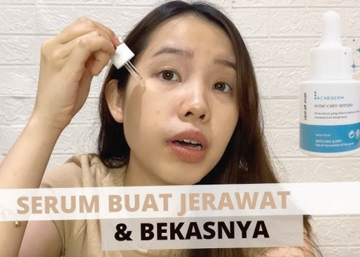 4 Rekomendasi Serum untuk Kulit Berjerawat, Redakan dan Pudarkan Bekas Noda Hitam Sekaligus