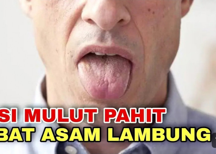 Tips Sederhana Atasi Mulut yang Pahit Karena Asam Lambung Naik ke Kerongkongan