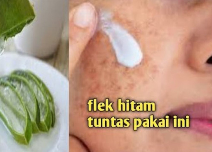 Cara Meracik Masker Lidah Buaya untuk Memutihkan Wajah dalam 1 Malam, Bye Kusam!