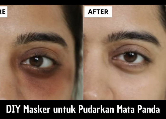 DIY Masker untuk Pudarkan Mata Panda, Cukup Pakai 2 Bahan Ini Lingkaran Hitam Hilang dan Cerah Lagi!