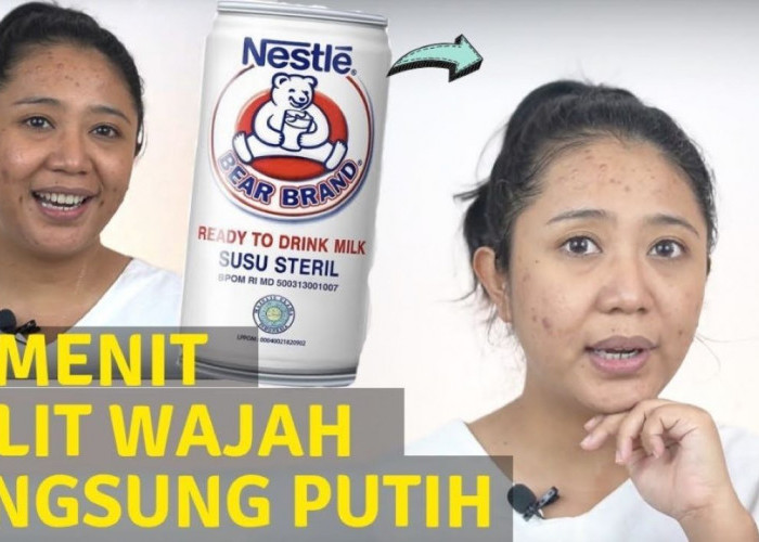 Begini Cara Pakai Susu untuk Menghilangkan Flek Hitam, Cukup Tambahkan 2 Bahan Alami Ini Saja