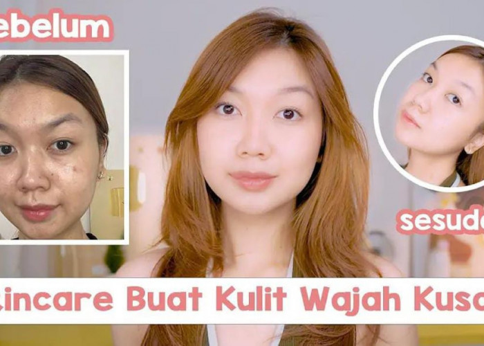 4 Rekomendasi Serum Vitamin C Termurah! Fokus Mencerahkan kulit hingga Mengatasi Noda Hitam 