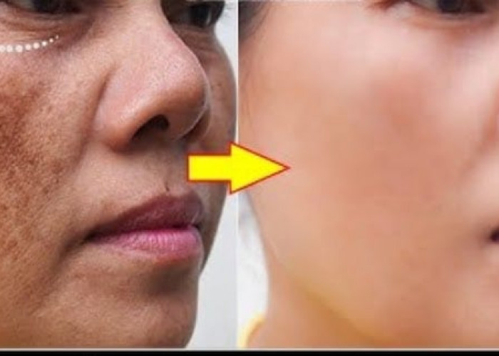 4 Sunscreen Terbaik untuk Flek Hitam Menahun, Bantu Kecilkan Pori Bikin Wajah Glowing dan Mulus