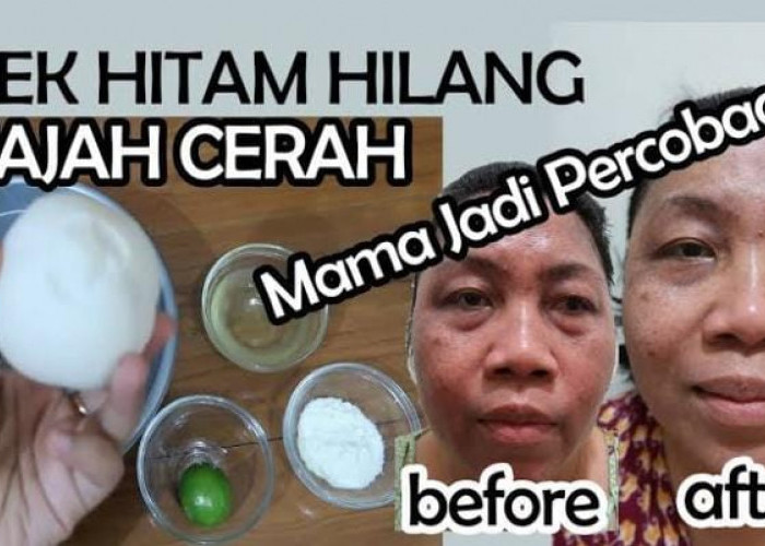 3 Cara Pakai Tepung Beras untuk Menghilangkan Flek Hitam, Kombinasikan dengan Bahan Ini Bikin Glowing Alami