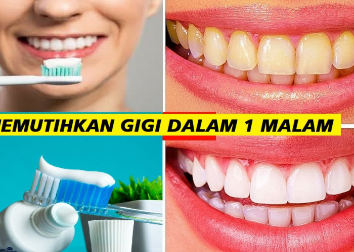 5 Merek Pasta Gigi yang Ampuh Memutihkan Gigi Secara Instan dalam 1 Malam, Gigi Bersih Bebas Plak Membandel