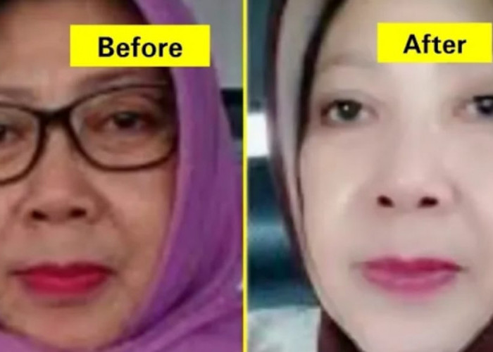 3 Masker untuk Mengencangkan Kulit Wajah Dalam 1 Malam, Pakai 2 Bahan Dapur Kulit Bebas Flek Hitam Permanen