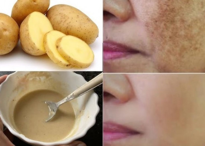 DIY Masker Kentang untuk Wajah Putih Tanpa Flek Hitam, Begini 2 Cara Meraciknya 