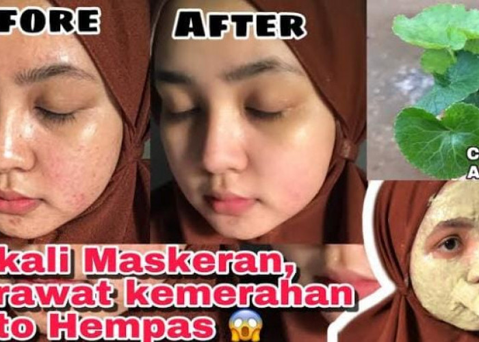 Masker Daun Pegagan Bikin Glowing dan Awet Muda, Begini Cara Pakainya Agar Usia 50 Tampak 20 Tahunan