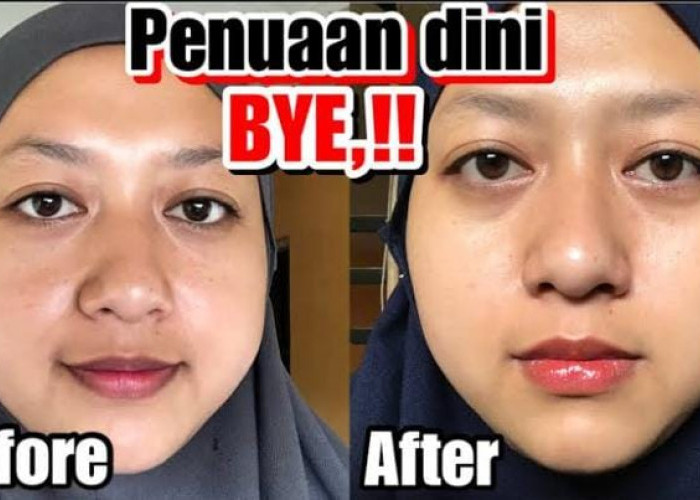 6 Serum untuk Mengencangkan Kulit Kendur dan Pudarkan Kerutan, Bagus untuk Ibu-Ibu yang Ingin Awet Muda