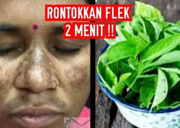 4 Daun Penghilang Flek Hitam di Wajah ini Ampuh Hempaskan Noda Hingga Kerutan, Wajah jadi Awet Muda!