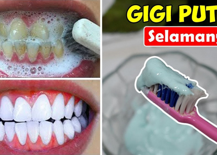 4 Cara Menghilangkan Karang Gigi dengan Baking Soda, Efektif Putihkan Gigi Hingga Bersih Anti Plak dan Karang