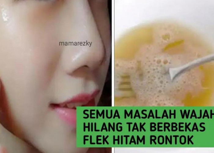 4 Tips Menghilangkan Flek Hitam Menahun di Wajah Secara Alami Dengan Cepat