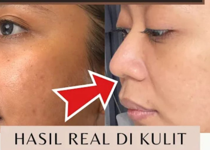 Inilah 3 Skincare Alami Agar Wajah Glowing dan Putih Permanen Dalam 1 Malam, Bantu Menghilangkan Noda Hitam