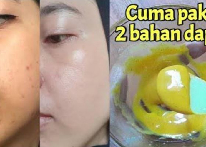 Begini 5 Cara Menghilangkan Flek Hitam dengan Masker Kunyit dalam 1 Malam, Tips Glowing Awet Muda Secara Alami