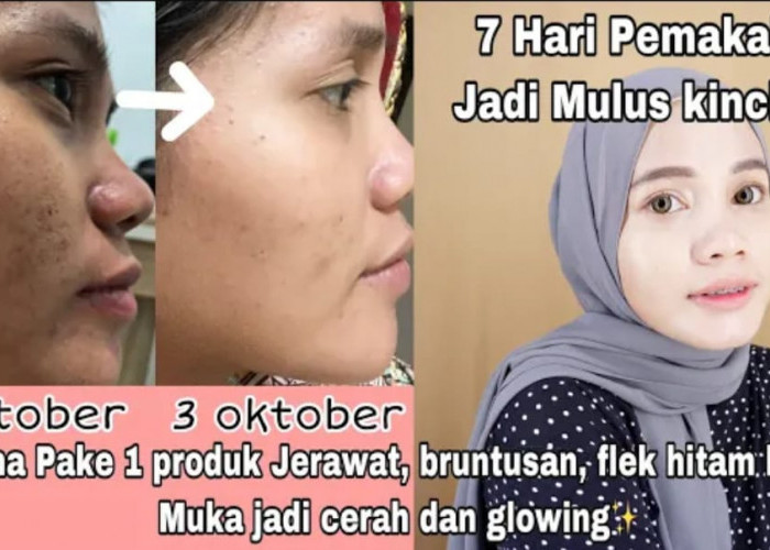 3 Daftar Skincare Penghilang Flek Hitam BPOM yang Murah, Ampuh Bikin Wajah jadi Putih Glowing Tanpa Noda Hitam