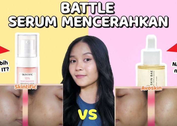 Review Battle Serum Pencerah Wajah Skintific vs Avoskin, Sama-sama Terkenal Mana Paling Cepat Memutihkan?