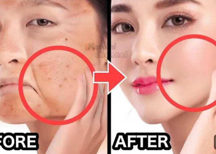 4 Cara Agar Wajah Terlihat Muda dan Bebas Kerutan Permanen, Wajah Glowing Bebas Noda Hitam Tanpa Skincare