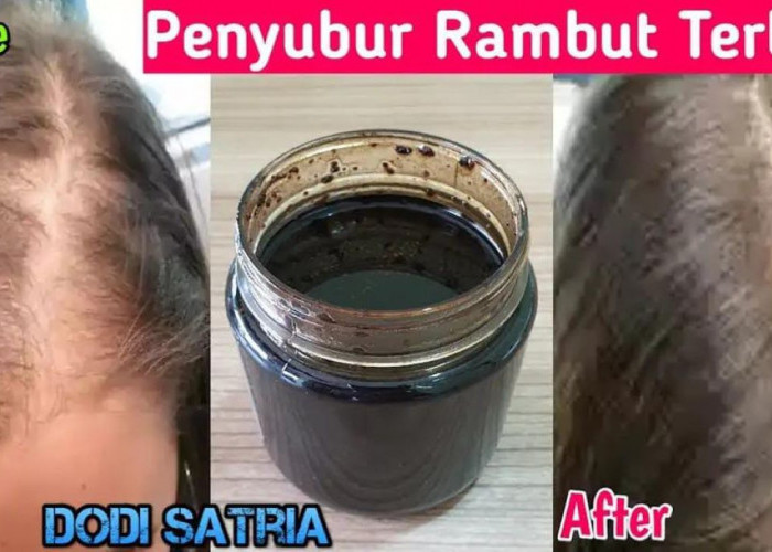 4 Minyak Alami Penghitam Rambut Uban Permanen, Bantu Hitamkan Rambut Hingga Akar