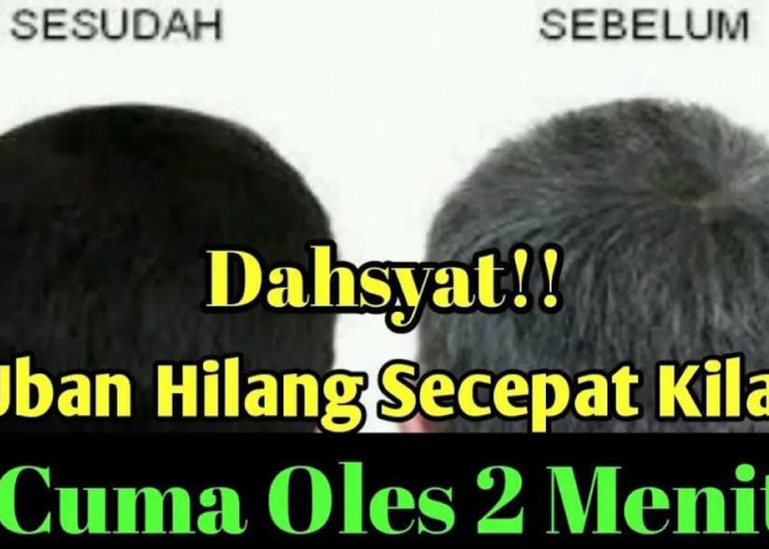 Mau Rambut Hitam Bebas Uban? Ini 3 Cara Menghitamkan Rambut Uban Dengan Bahan Alami, Hasil Hitam Permanen