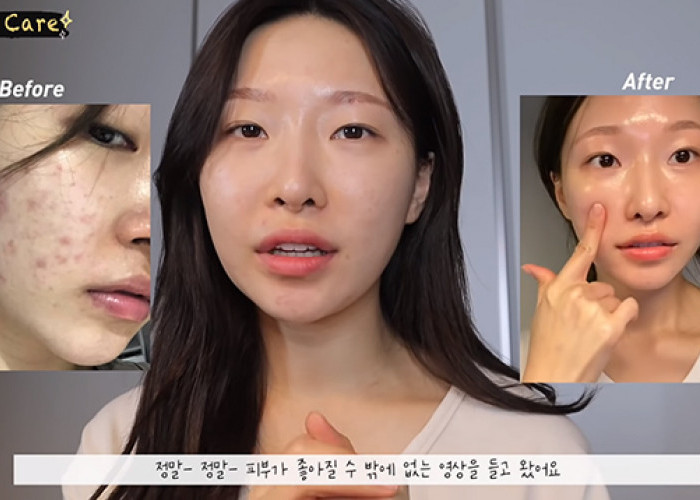 5 Skincare Korea Paling Ampuh untuk Memutihkan Wajah, Sudah BPOM dan Bebas Merkuri Tersedia di Shopee