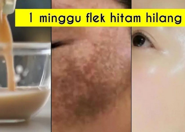 4 Tips Wajah Glowing Alami Agar Flek Hitam Hilang dan Kulit Jadi Kencang Awet Muda