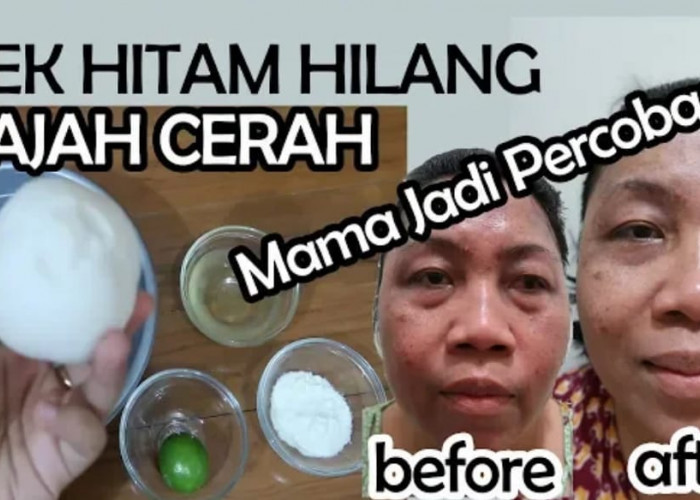 Pengalamanku menghilangkan Flek Hitam dengan Jeruk Nipis! Wajah Putih Glowing Serta Bebas Kerutan