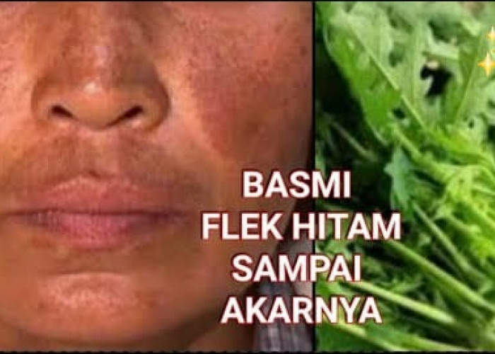 Inilah Daun untuk Menghilangkan Flek Hitam, Cukup 1 Bahan Bikin Wajah Glowing Awet Muda Tanpa Noda