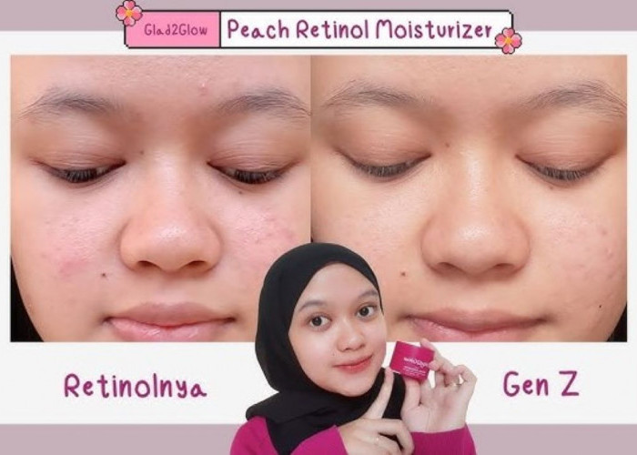 Apakah Moisturizer Retinol untuk Mengurangi Tanda Penuaan Pilihanmu Sudah Tepat? Ini 3 Rekomendasinya 