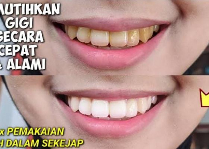 Cara Memutihkan Gigi Berkerak dalam 1 Malam, Cuma Pakai 1 Jenis Buah Gigi Kuning Jadi Putih Permanen