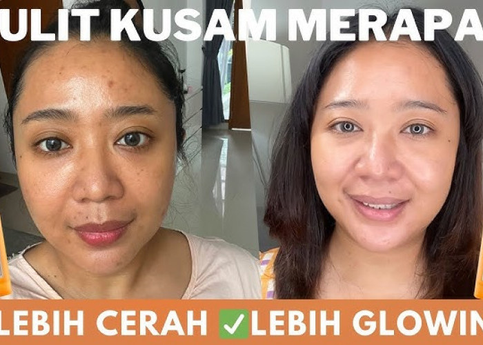 4 Serum untuk Menghilangkan Flek Hitam dan Pori-Pori Wajah, Bikin Mulus Awet Muda Tanpa Efek Samping