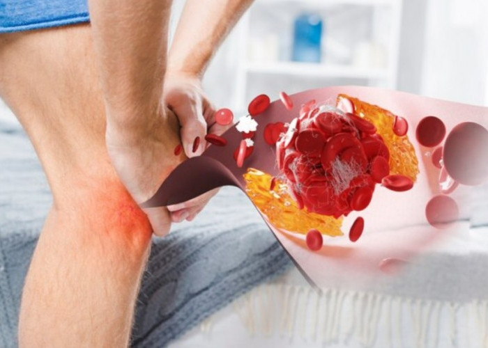 Mengatasi Nyeri Sendi dengan Cepat, Inilah 7 Obat yang Bisa Dikonsumsi Aman dan Sehat