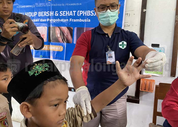 20 Anak Suspek Penyakit Frambusia