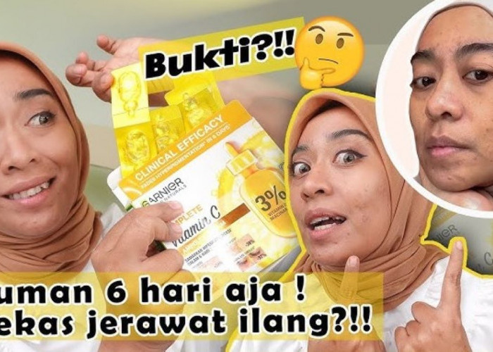 4 Produk Garnier yang Pudarkan Flek Hitam dengan Cepat, Wajah Glowing dan Mulus Awet Muda