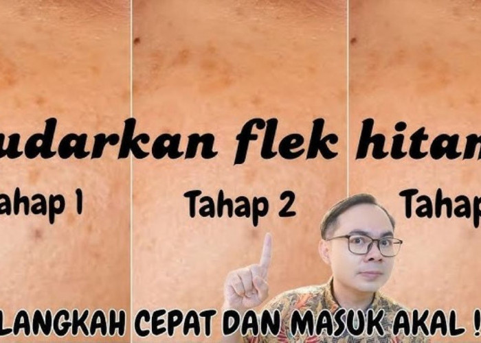 5 Rekomendasi Skincare Flek Hitam untuk Warga Pekalongan, Rahasia Wajah Glowing dengan Produk BPOM!