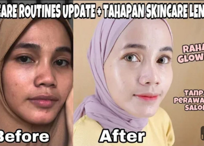3 Daftar Skincare Bpom Murah untuk Memutihkan Wajah, Bantu Hilangkan Noda Hitam dan Bikin Wajah Bebas Kilap