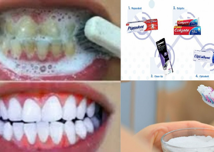 5 Merek Pasta Gigi yang Ampuh untuk Merontokan Karang Gigi yang Sudah Mengeras, Gigi Putih Bersih Tanpa Plak