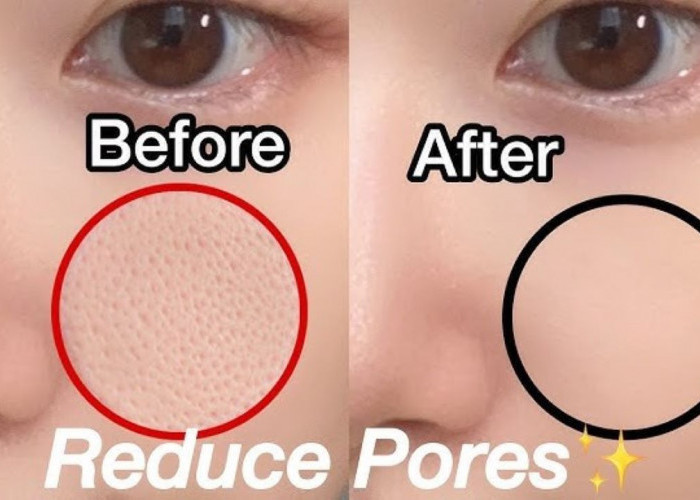 4 Serum Pengecil Pori-Pori yang Terbuka, Bikin Wajah Mulus dan Glowing