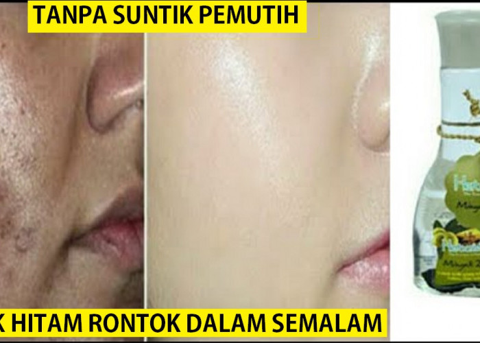 3 Daftar Merek Minyak Zaitun yang Ampuh untuk Merontokkan Flek Hitam, Kulit Glowing Permanen, Lembut dan Kenya