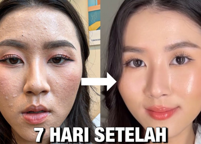 5 Rekomendasi Skincare yang Bagus untuk Kulit Kering dan Kusam Saat Puasa