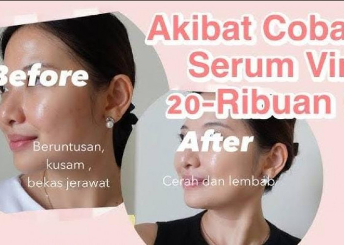 4 Serum Terbaik untuk Ibu-Ibu Agar Wajah Bebas Kerutan dan Flek Hitam, Efektif Memutihkan Wajah Jadi Mulus