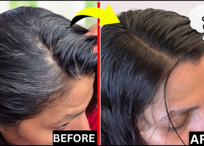 Ini Dia Cara Ampuh Menghilangkan Uban dengan Baby Oil, Bisa Bikin di Rumah
