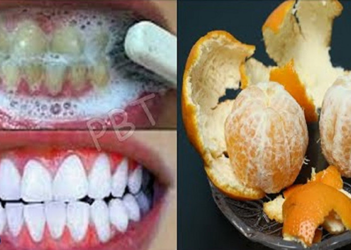 Cara Mudah Menghilangkan Karang Gigi yang Sudah Menebal dan Mengeras dengan Kulit Jeruk, Efektif dalam 1 Hari