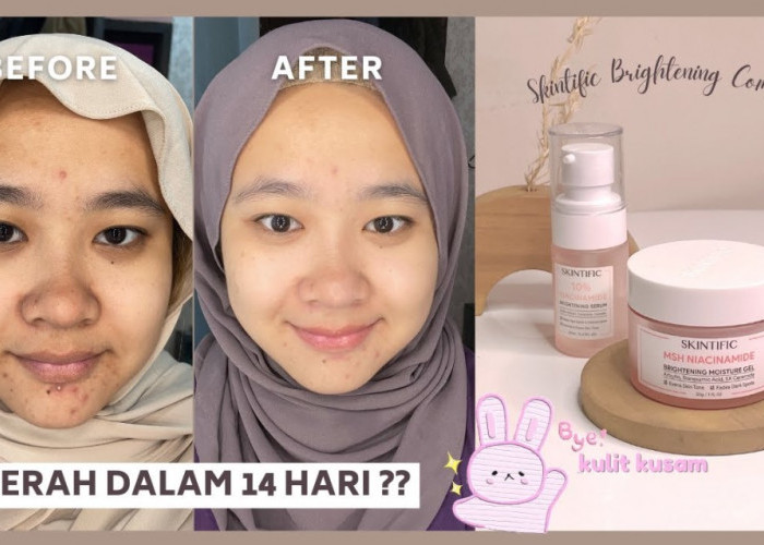 4 Produk Skintific untuk Kulit Cerah dan Glowing, Solusi Atasi Wajah Kusam