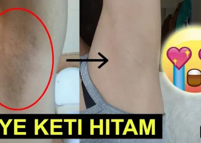 4 Tips Agar Tidak Bau Badan dan Ketiak jadi Putih Permanen, Cuma Pakai 1 Bahan Bebas Bau Meski Berkeringat