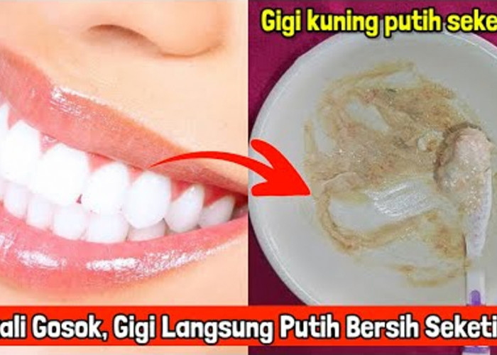 3 Cara Menghilangkan Gigi Kuning yang Sudah Lama Secara Alami