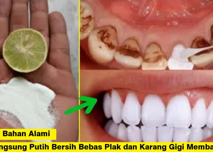 6 Cara Praktis Menghilangkan Plak dan Karang Gigi Membandel, Gigi Langsung Putih Bersih dan Sehat Anti Plak 