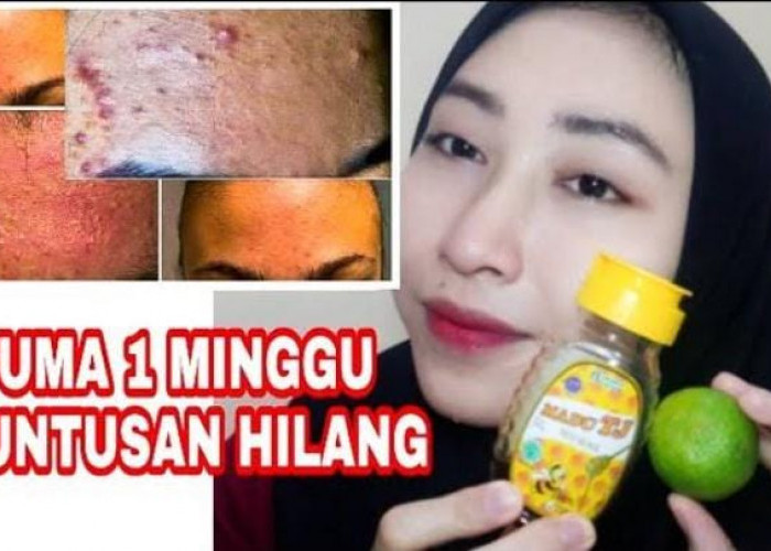 4 Masker Alami untuk Kulit Berminyak dan Berjerawat, Efektif Mengecilkan Pori-Pori dan Kontrol Minyak Berlebih