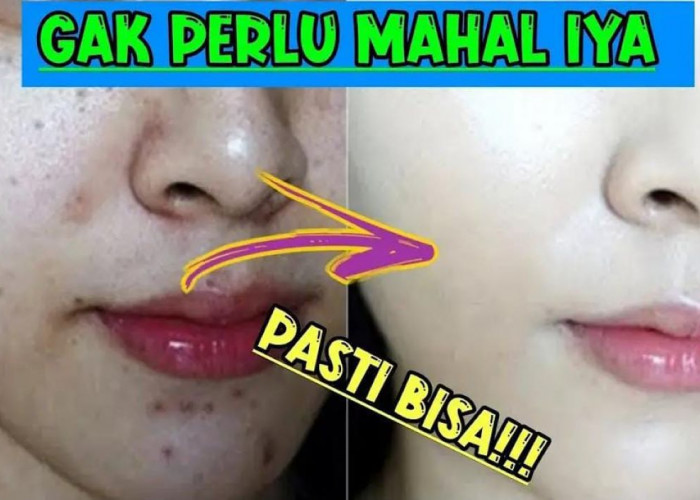 Diy Masker Minyak Zaitun untuk Mengelupas Flek Hitam Dalam 1 Malam, Begini Cara Buatnya